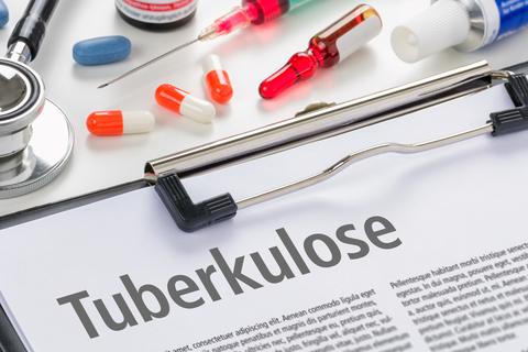 Tuberkulose ist eine Infektionskrankheit, die bevorzugt die Lunge betrifft. Neben HIV und Malaria gehört sie weltweit immer noch zu den häufigsten Infektionskrankheiten. Symbolfoto: Boris Zerwann - adobe.stock