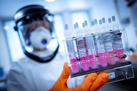 Eine Wissenschaftlerin hält Coronavirus-Testproben in der Hand.  Symbolfoto: dpa